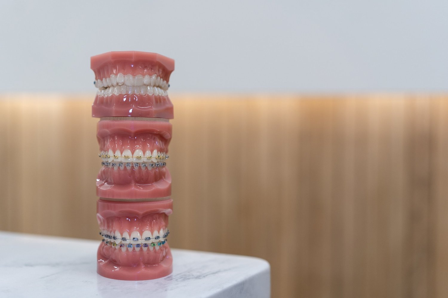 The Difference Between Braces and Invisalign: Which is Right for You?
