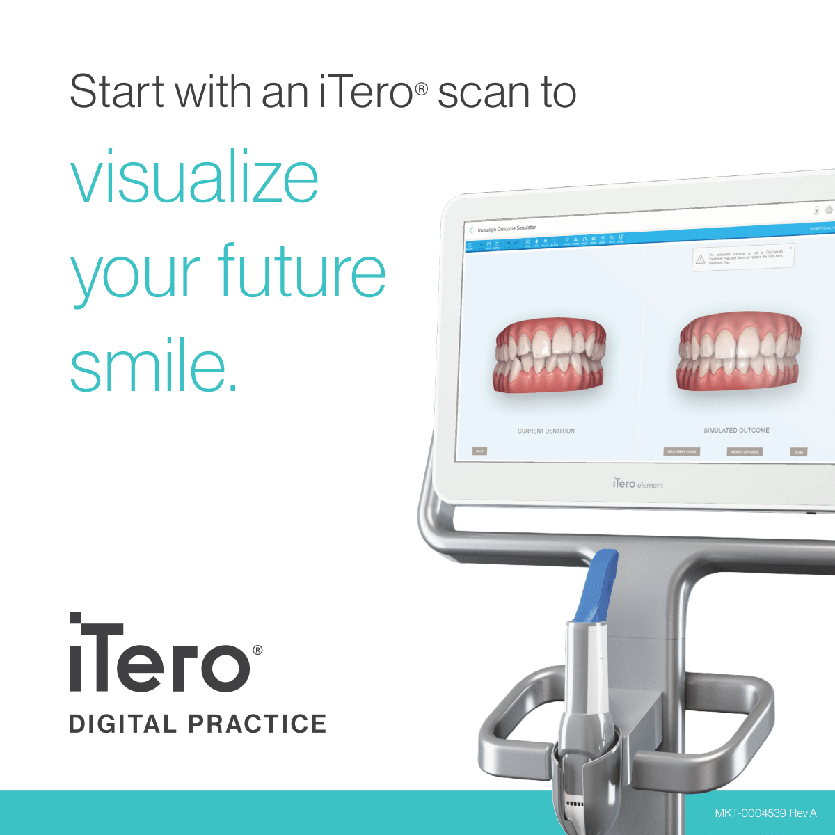 iTero Digital Impressions technology